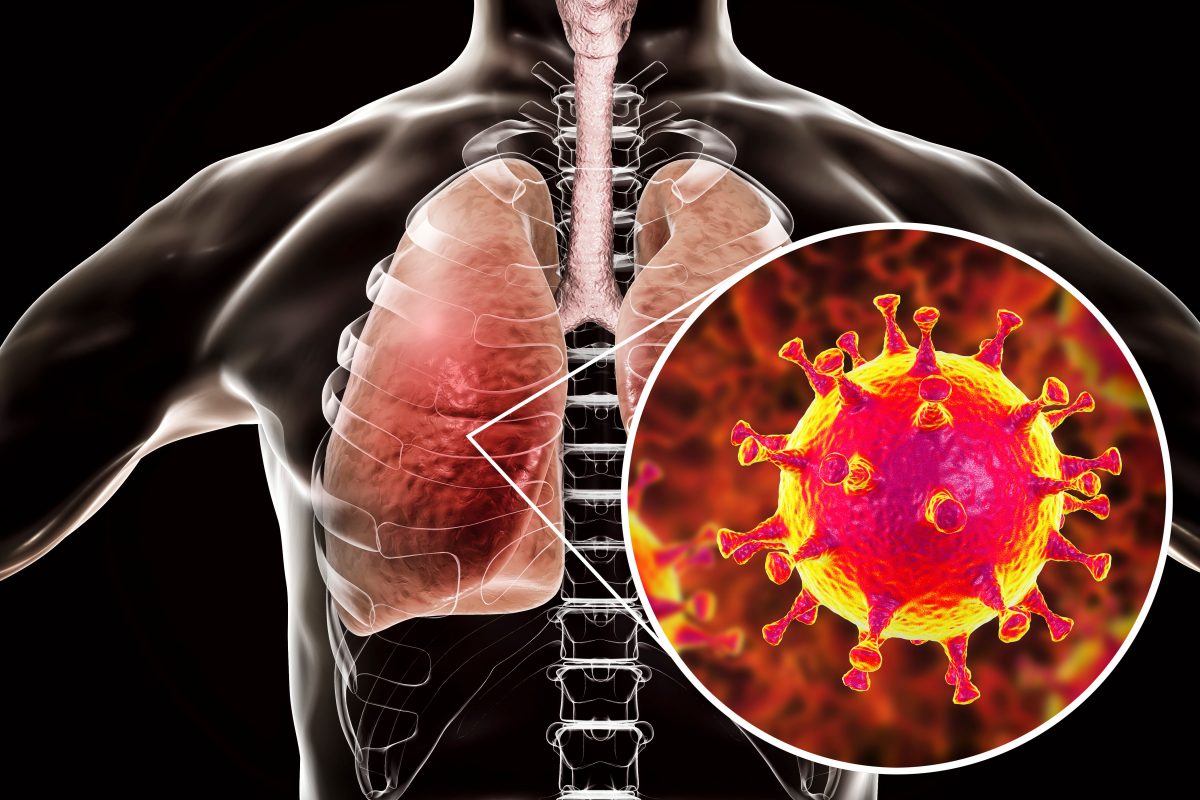 Middle East Respiratory Syndrome (MERS) Naugatuck Valley Health District